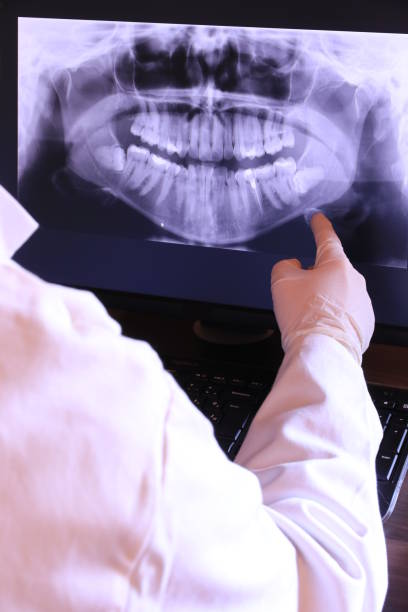 Best Knocked-Out Tooth (Avulsed Tooth) Treatment in Mounds View, MN