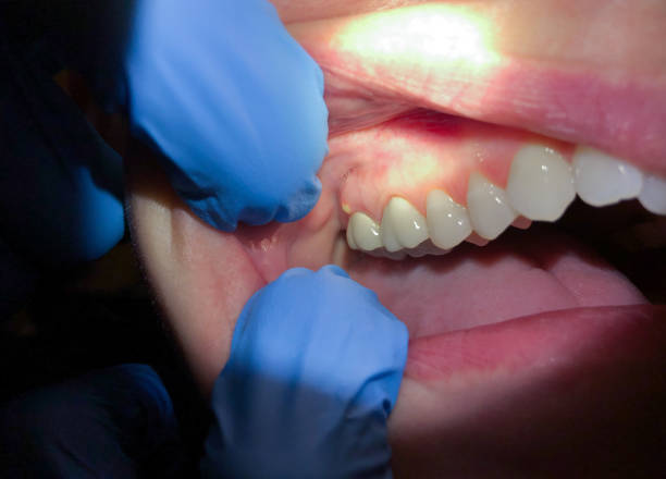 Best Emergency Treatment for Jaw Pain or Injury in Mounds View, MN
